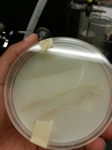 B. subtilis and Enterobacter aerogenes on Skim milk Agar (top view)