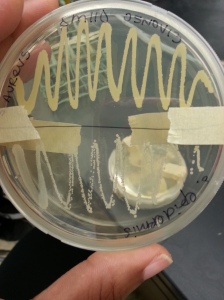 S.Aureus (top). S.Epidermis (bottom) on Staphylococcus Medium 110 agar.