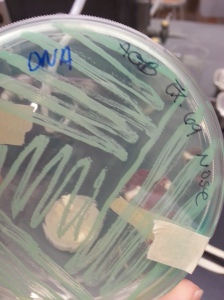 S. Aureus (bottom view). Isolated from nasal swab on DNase agar with methyl green