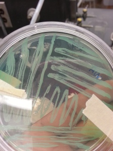 S. Aureus (top view). Isolated from nose swab on DNase agar with methyl green