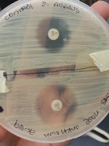 Novobiocin Susceptibilty Test (bottom view). Lab-provided S.Aureus (top). S.Aureus isolated from nose swab (bottom). On Mueller-Hinton agar.